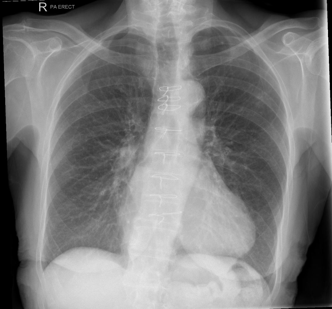 Case 5